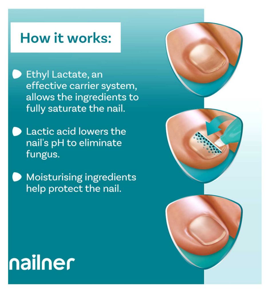 Fungal Nail Treatment Pen