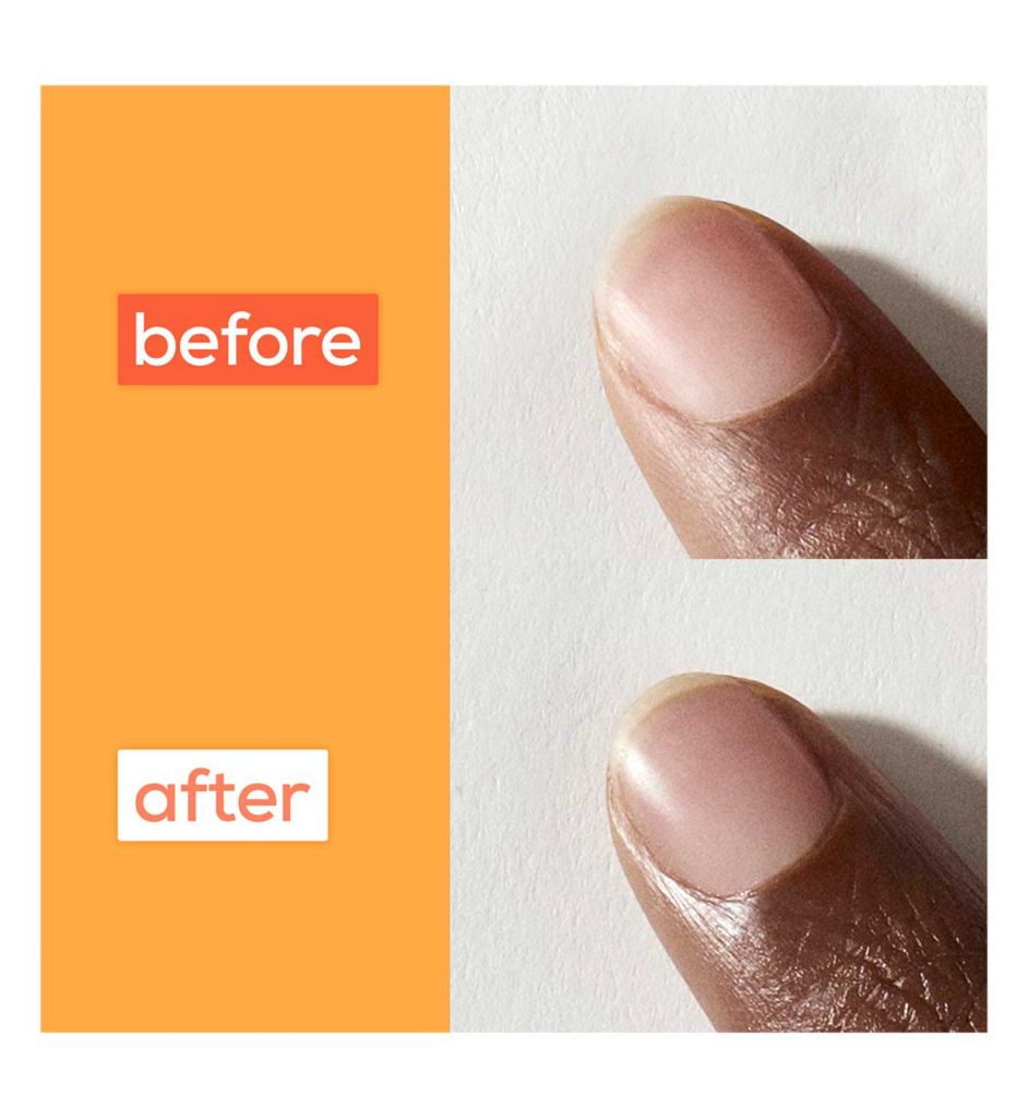 Nail Care Apricot Cuticle Oil Treatment, Heal & Repair At Home Manicure Oil Nourishing, Softening, Moisturizing